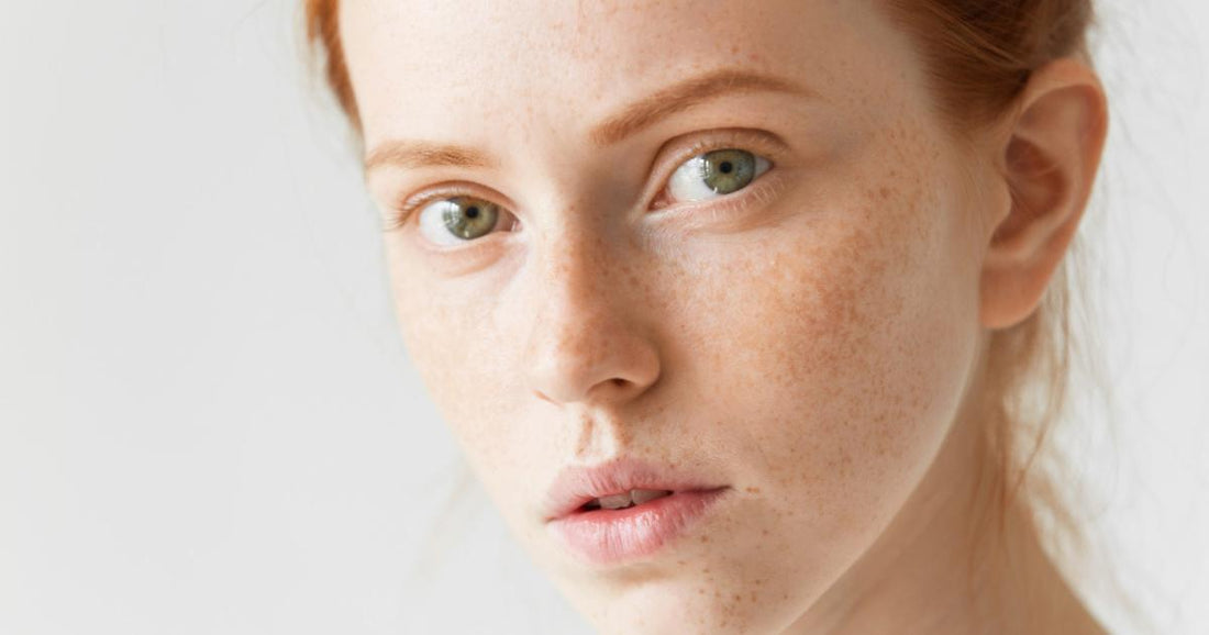Uneven Skin Tone and Pigmentation