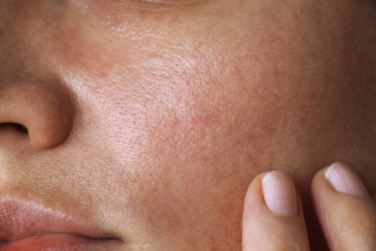 Stop Overstimulating Your Skin
