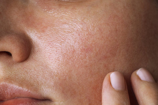 Stop Overstimulating Your Skin