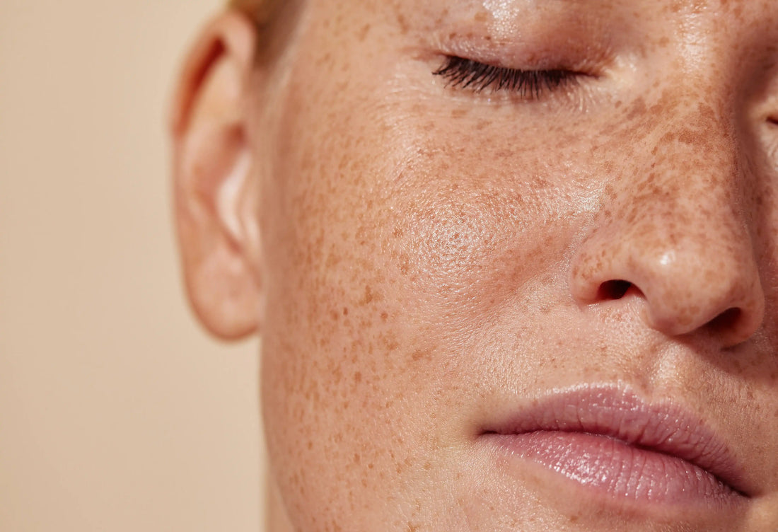 Sun Damage You Cannot See Yet: How to Support Skin in August
