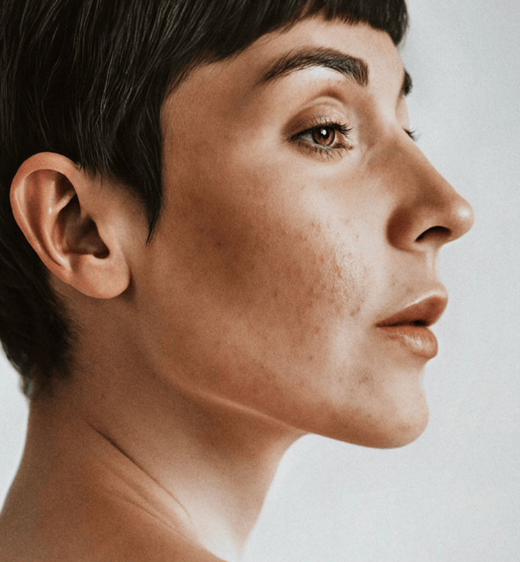 Congested & Oily Skin Diagnosis
