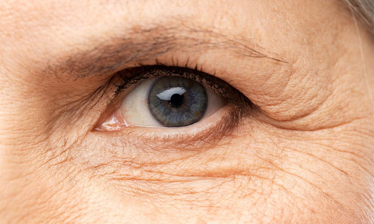 Multiple Signs of Ageing & Deep Wrinkles