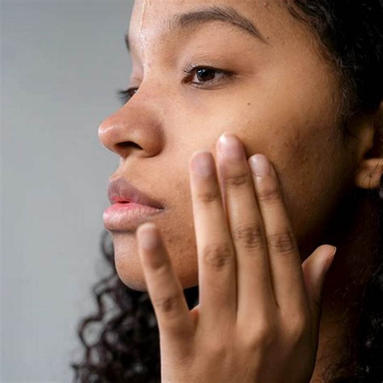Dull Complexion